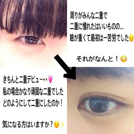 二重の作り方/その他を使ったクチコミ(1枚目)