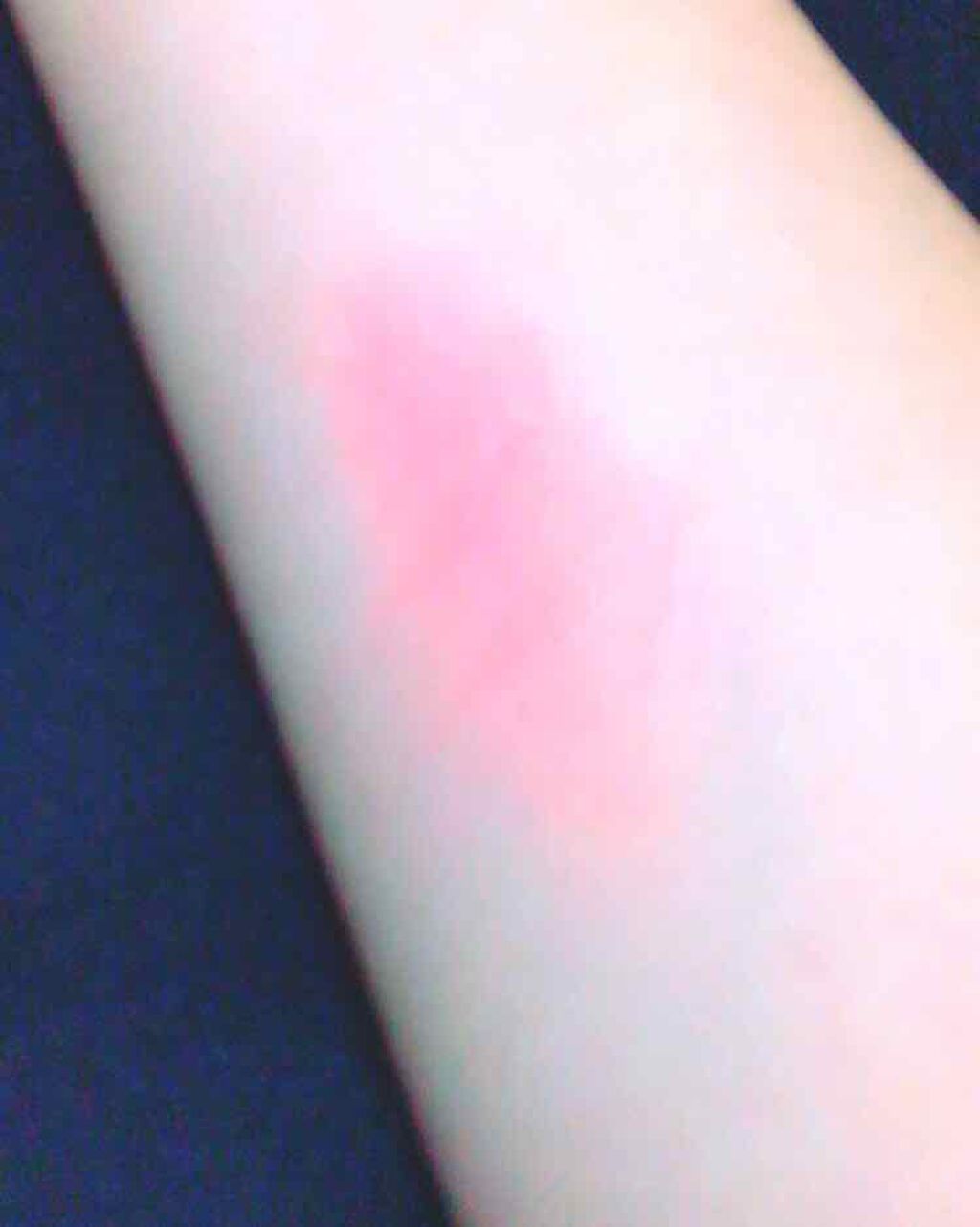 リップ&チーク/マリブビューティー/ジェル・クリームチークを使ったクチコミ(3枚目)