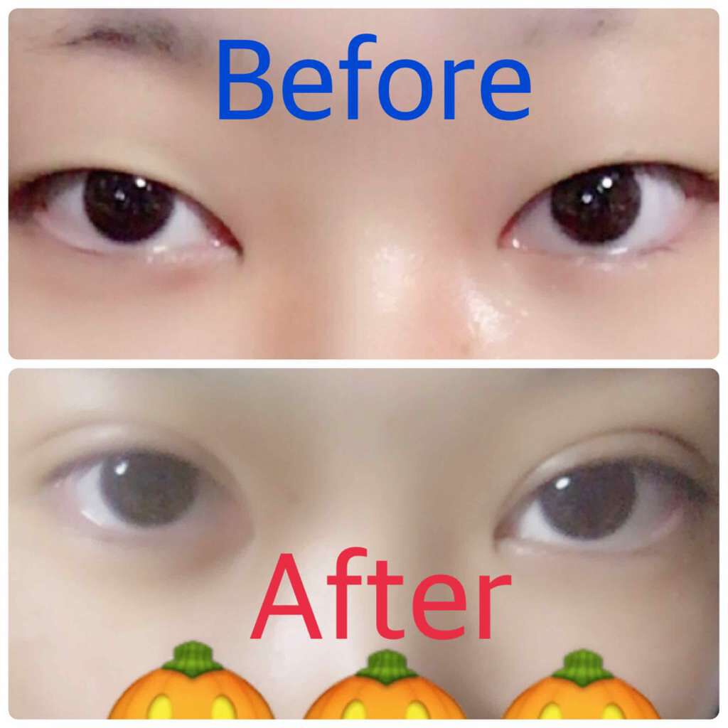 ミセルD-ラインジェル/美健コーポレーション/二重まぶた用アイテムを使ったクチコミ(1枚目)