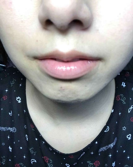 ユイルカレス/ロレアル パリ/リップグロスを使ったクチコミ(2枚目)