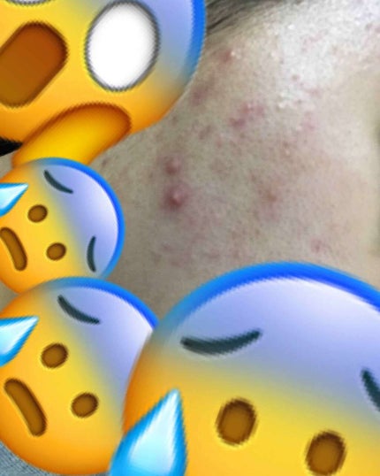 ハトムギ化粧水(ナチュリエ スキンコンディショナー R )/ナチュリエ/化粧水を使ったクチコミ(2枚目)