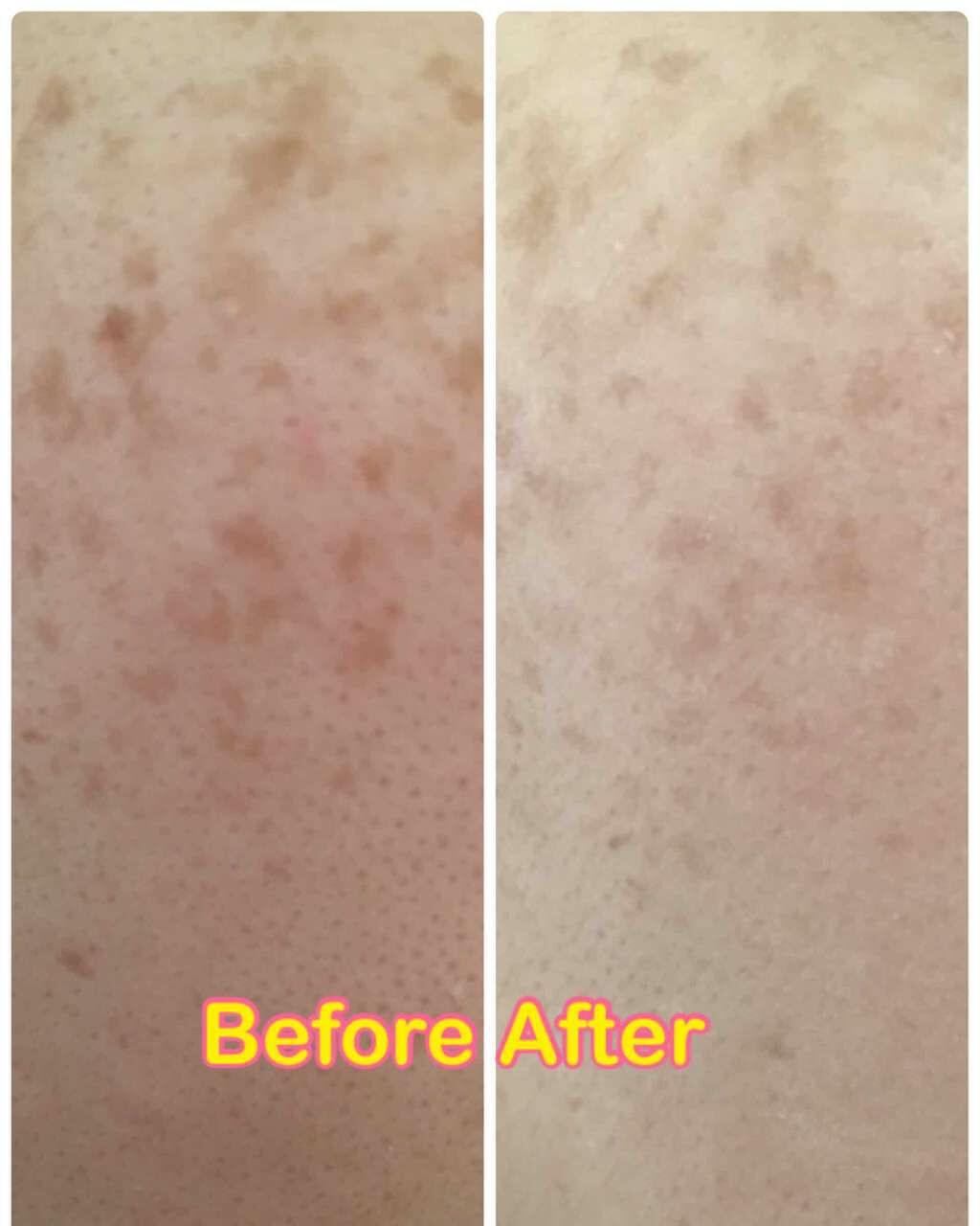 スノースキンCCベース/KATE/CCクリームを使ったクチコミ(3枚目)