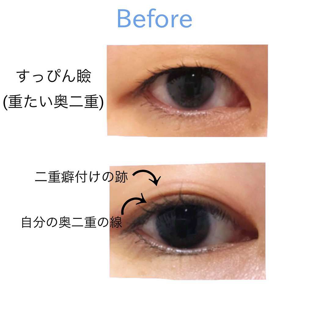 ローヤルプチアイムII/ROYAL/二重まぶた用アイテムを使ったクチコミ(2枚目)