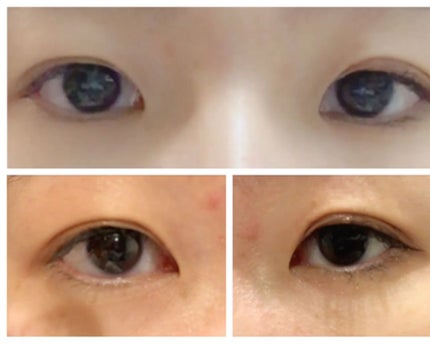 ローヤルプチアイムII/ROYAL/二重まぶた用アイテムを使ったクチコミ(4枚目)