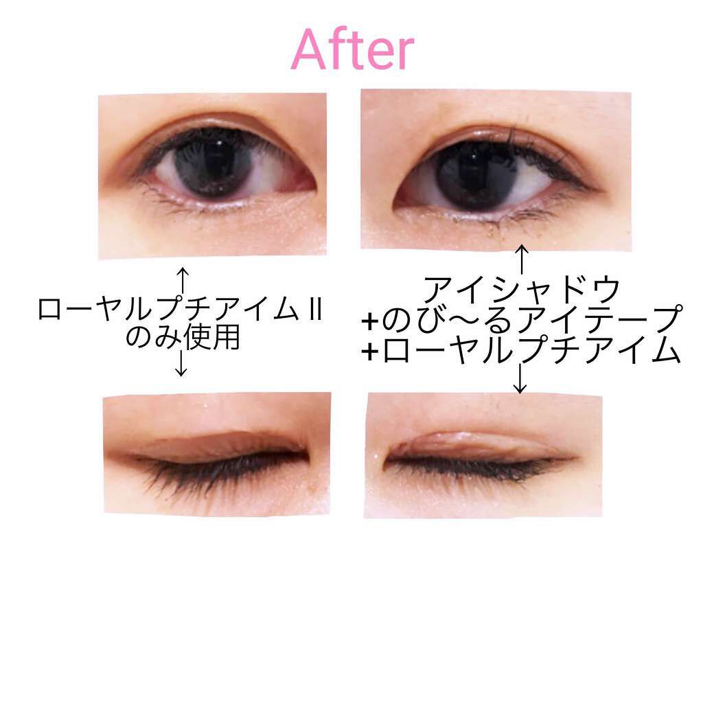 ローヤルプチアイムII/ROYAL/二重まぶた用アイテムを使ったクチコミ(3枚目)