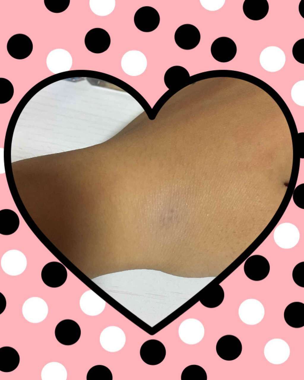 ユース エフエックス フィル+ブラー コンシーラー/REVLON/リキッドコンシーラーを使ったクチコミ(3枚目)