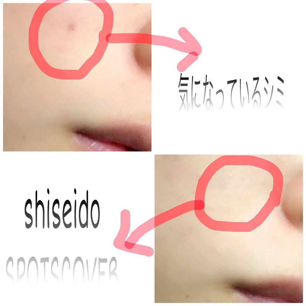 スポッツカバー ファウンデイション/SHISEIDO/クリームコンシーラーを使ったクチコミ（3枚目）