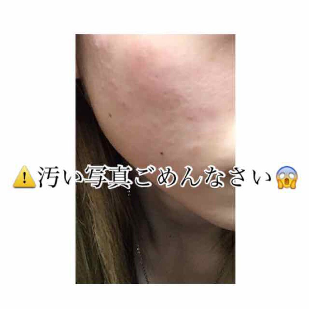 おうちdeエステ 肌をやわららかくする マッサージ洗顔ジェル/ビオレ/その他洗顔料を使ったクチコミ(2枚目)