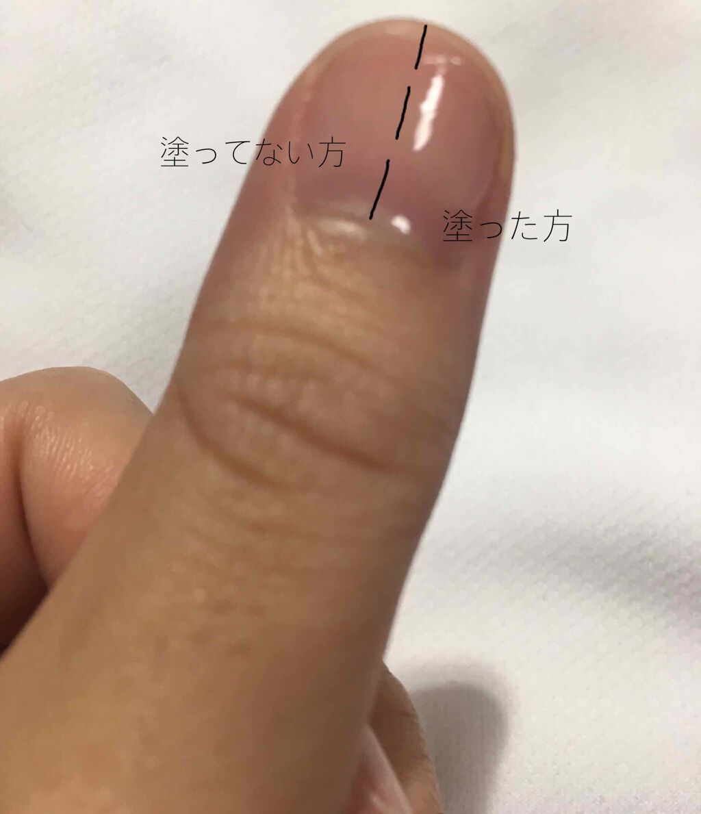 エテュセ クイックケアコート/ettusais/ネイルオイル・トリートメントを使ったクチコミ(3枚目)