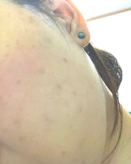 マスターカモフラージュデュオ/MAYBELLINE NEW YORK/スティックコンシーラーを使ったクチコミ(4枚目)