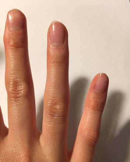 ハトムギ化粧水(ナチュリエ スキンコンディショナー R )/ナチュリエ/化粧水を使ったクチコミ(3枚目)