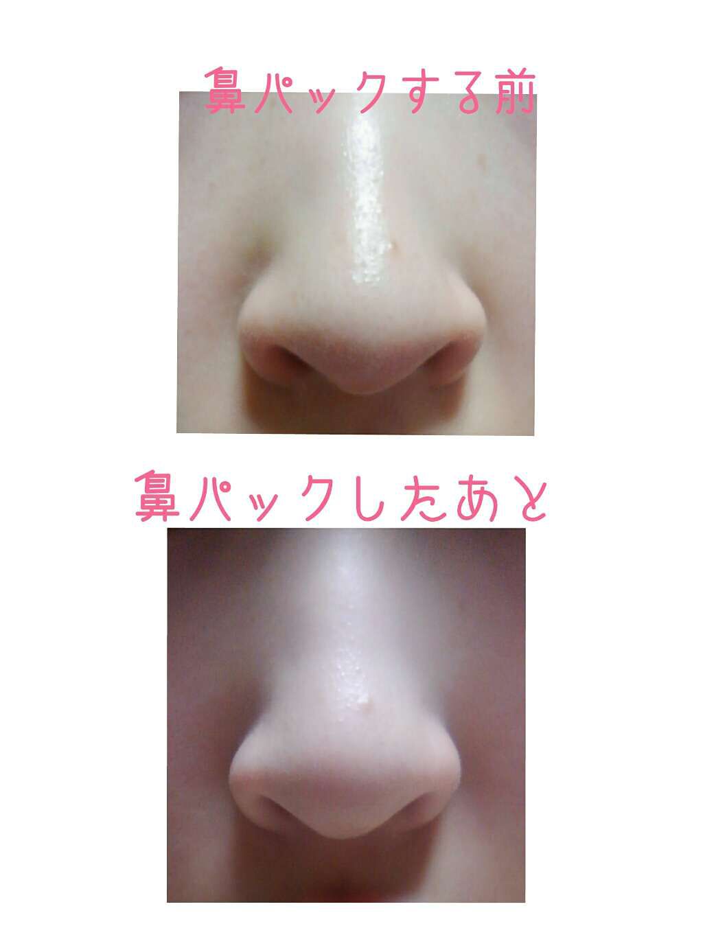 ツルリ 皮脂吸い出し 部分用パック ガスール&レッドパワー/ツルリ/洗い流すパック・マスクを使ったクチコミ(3枚目)