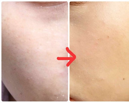 ミルキィフィットフルイド/excel/リキッドファンデーションを使ったクチコミ(2枚目)