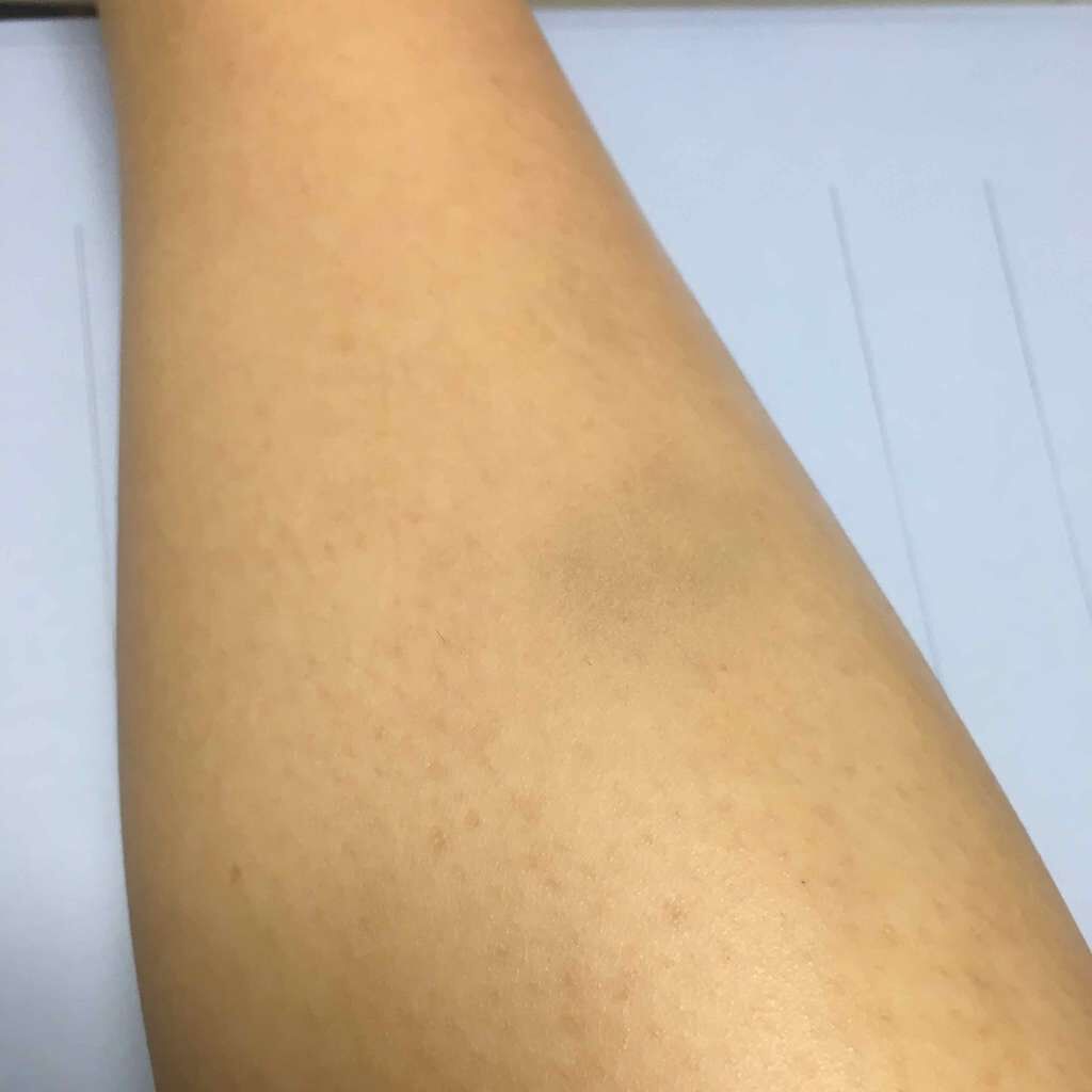 リシェ フォギーオン チークス/Visée/パウダーチークを使ったクチコミ(2枚目)