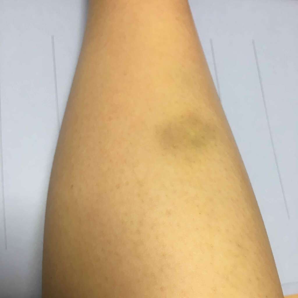 リシェ フォギーオン チークス/Visée/パウダーチークを使ったクチコミ(3枚目)