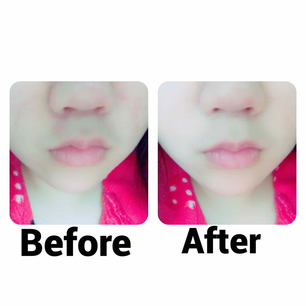 マジックコンシーラー/カリプソ/リキッドコンシーラーを使ったクチコミ(2枚目)