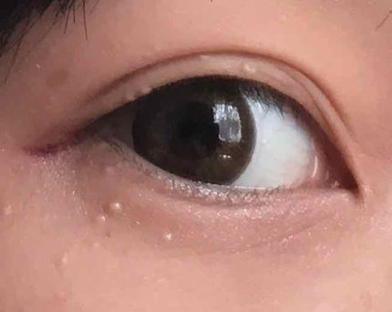 アクメディカ 薬用 オイルコントロールパウダーWH クリア/ナリスアップ/プレストパウダーを使ったクチコミ(4枚目)