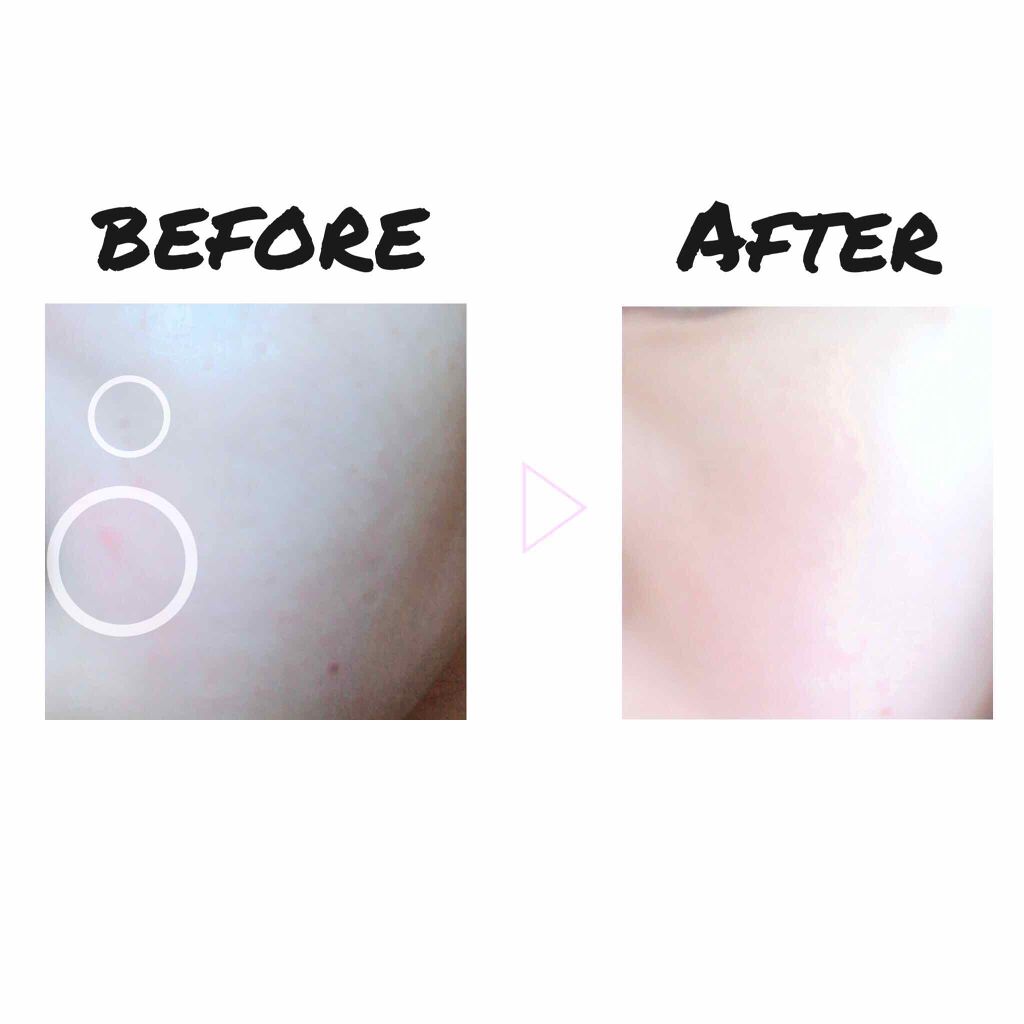 カバー&ストレッチコンシーラー UV/キャンメイク/リキッドコンシーラーを使ったクチコミ(2枚目)