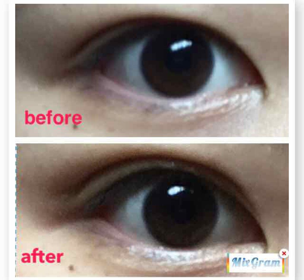 ふたえパテ ハード/プレビュート/二重まぶた用アイテムを使ったクチコミ（1枚目）