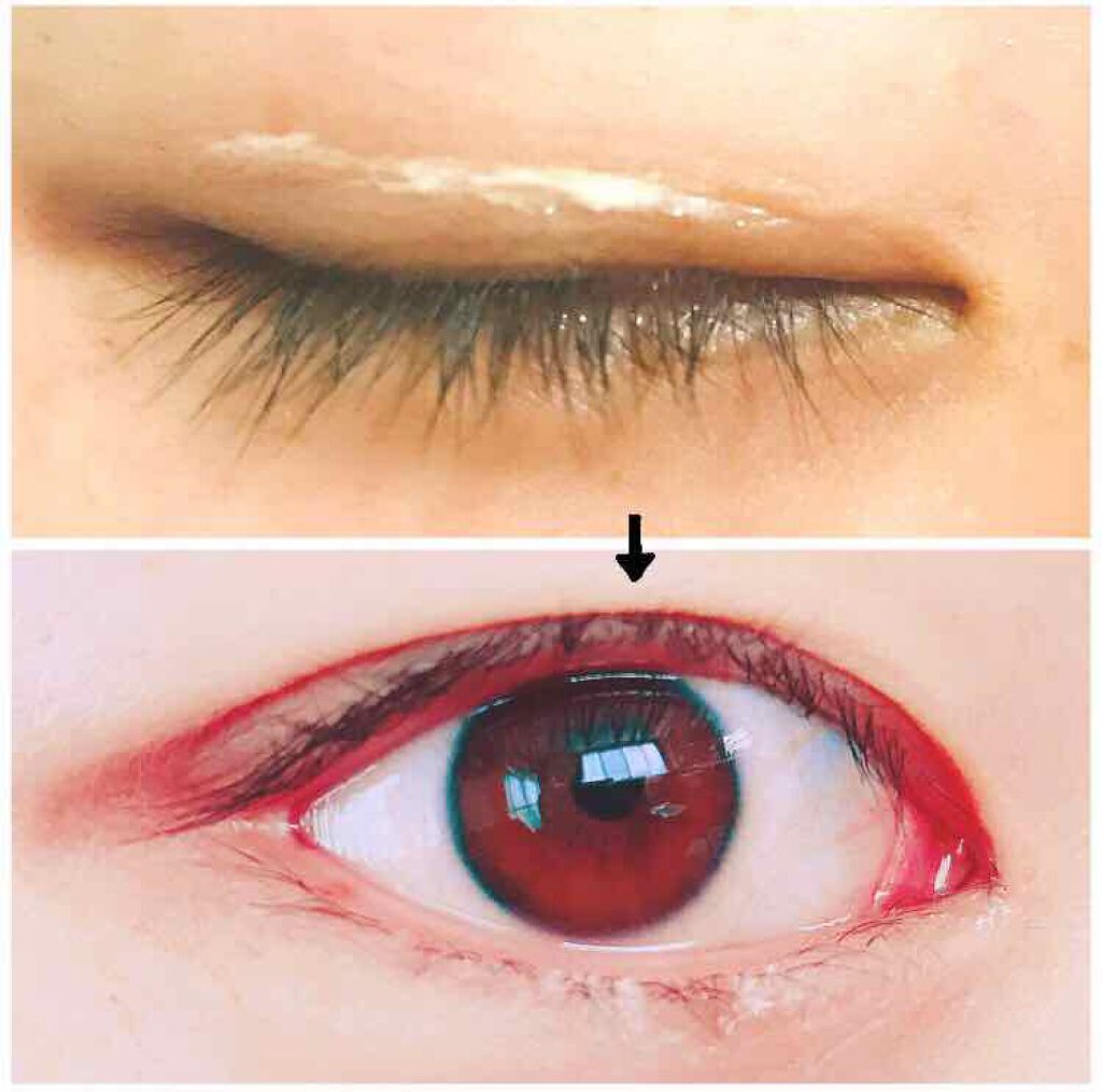 アクティブアイトークII/アイトーク/二重まぶた用アイテムを使ったクチコミ（2枚目）