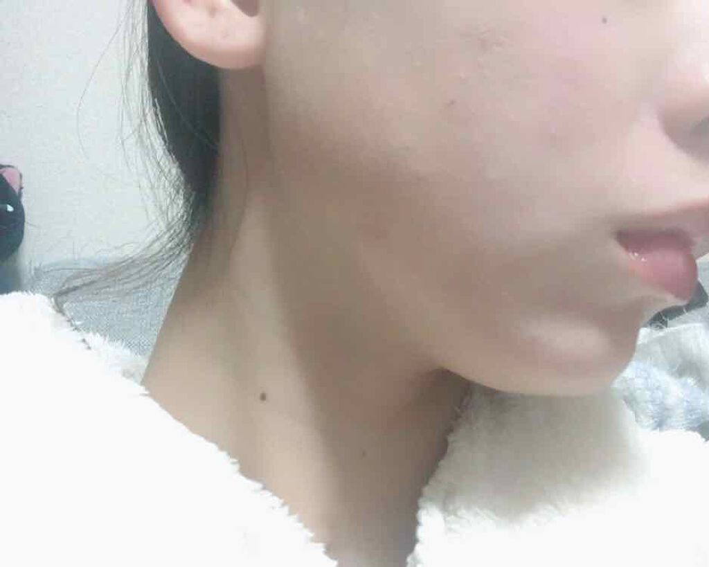 スポッツカバー ファウンデイション/SHISEIDO/クリームコンシーラーを使ったクチコミ(3枚目)