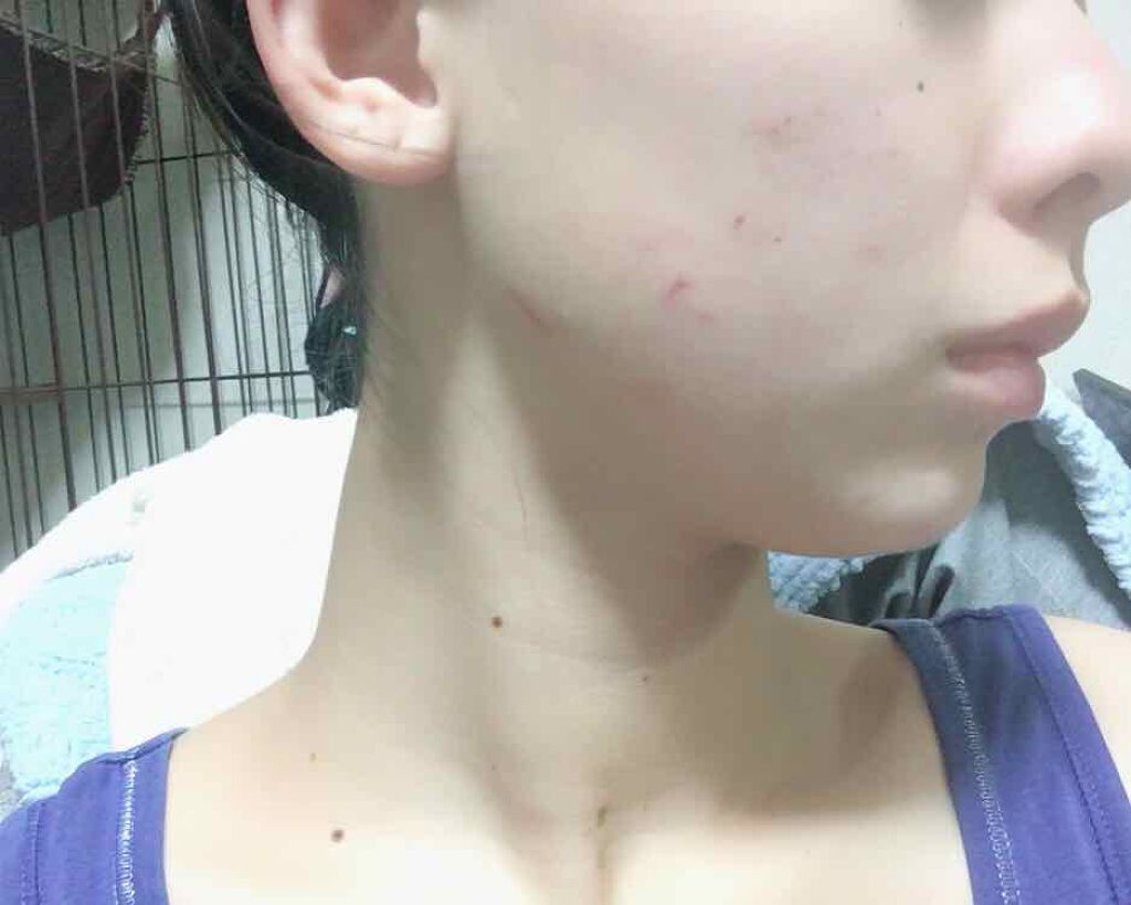 スポッツカバー ファウンデイション/SHISEIDO/クリームコンシーラーを使ったクチコミ(2枚目)