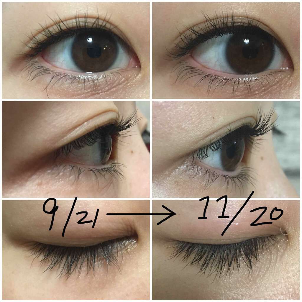 スカルプD ボーテ ピュアフリーアイラッシュセラム/アンファー(スカルプD)/まつげ美容液を使ったクチコミ(2枚目)