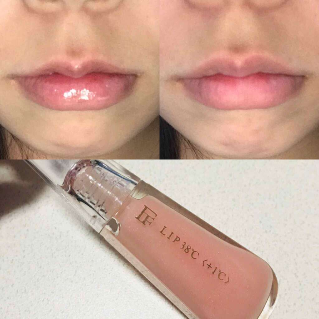 38°C / 99°F リップトリートメント (リップ美容液)/UZU BY FLOWFUSHI/リップケアを使ったクチコミ(2枚目)