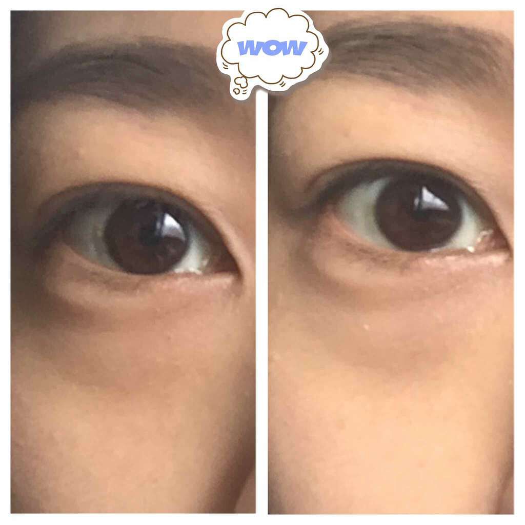 スムースタッチクレヨンコンシーラー/Rond et Rond/ペンシルコンシーラーを使ったクチコミ(2枚目)