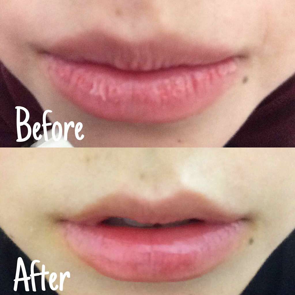 ボリュームアップレディグロス/キャンメイク/リップグロスを使ったクチコミ(1枚目)