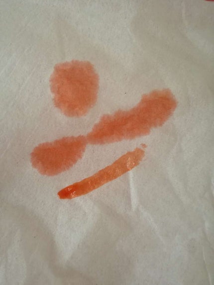 ウォーターティント/ETUDE/リップグロスを使ったクチコミ(2枚目)