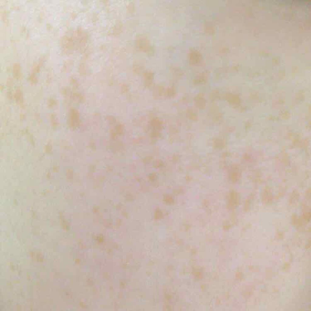 カバーパーフェクション チップコンシーラー/the SAEM/リキッドコンシーラーを使ったクチコミ（2枚目）