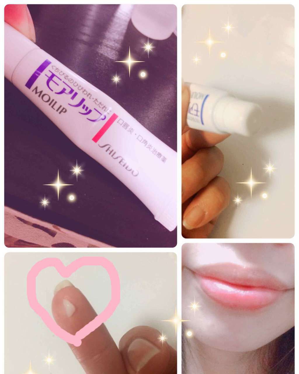 モアリップ N (医薬品)/資生堂薬品/その他を使ったクチコミ（1枚目）