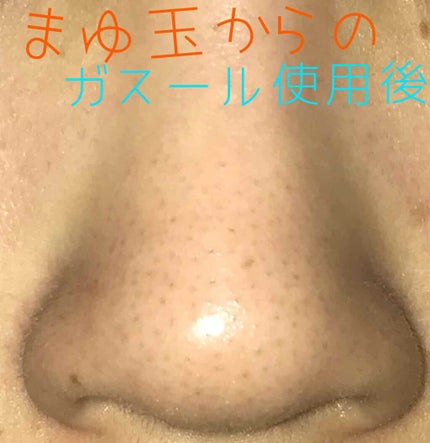 ガスール固形/ナイアード/洗顔石鹸を使ったクチコミ(4枚目)