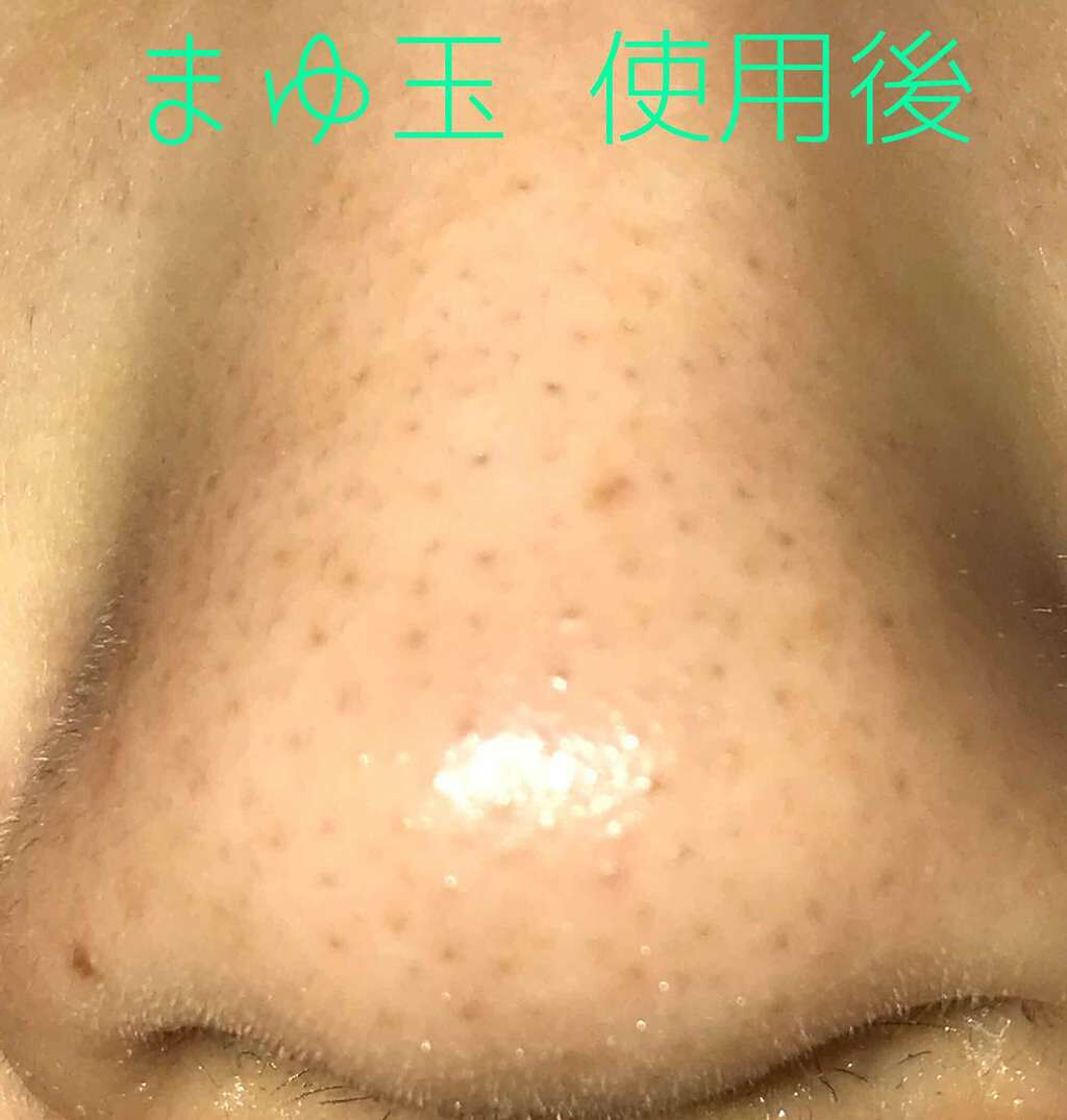 ガスール固形/ナイアード/洗顔石鹸を使ったクチコミ(3枚目)