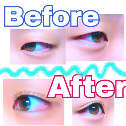 アイビューティー フィクサー WP/アストレア ヴィルゴ/二重まぶた用アイテムを使ったクチコミ(1枚目)