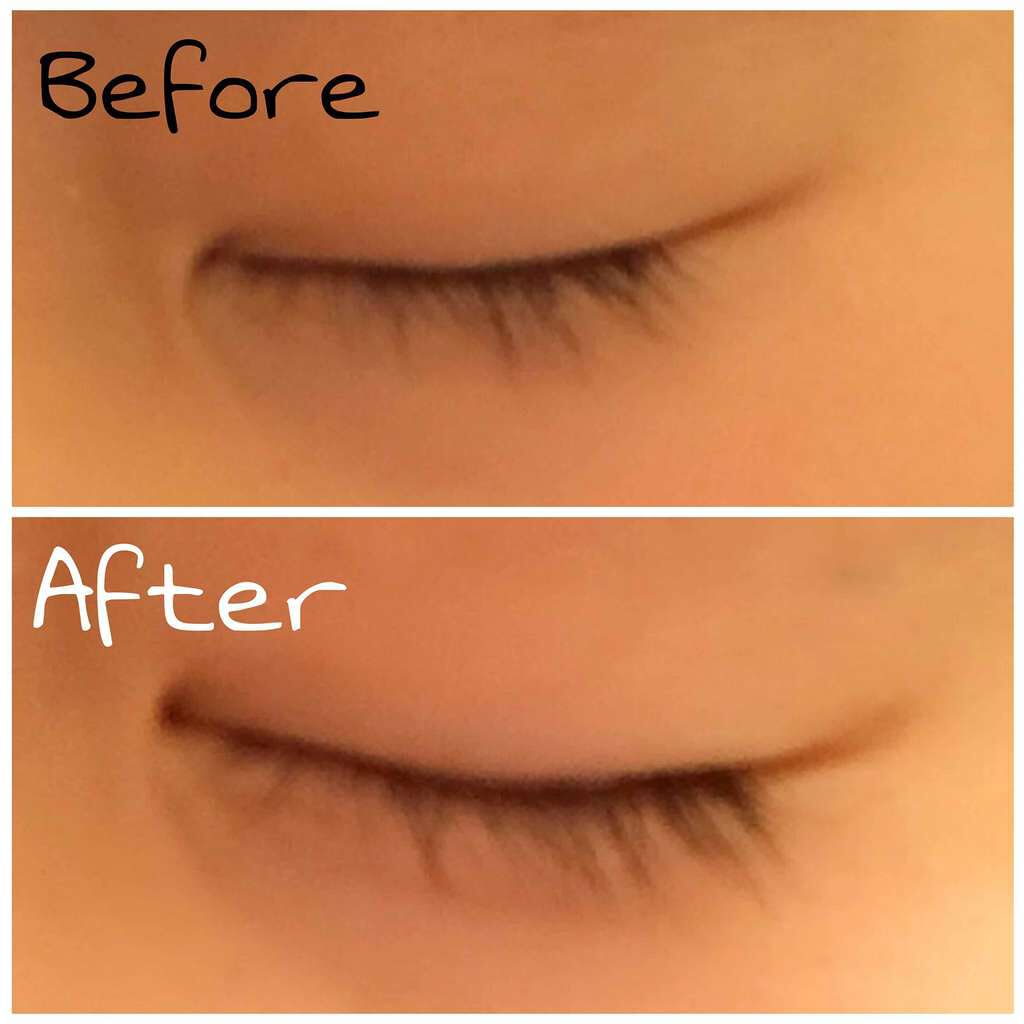 ローヤルゼリー配合 栄養ローション/DAISO/美容液を使ったクチコミ(2枚目)