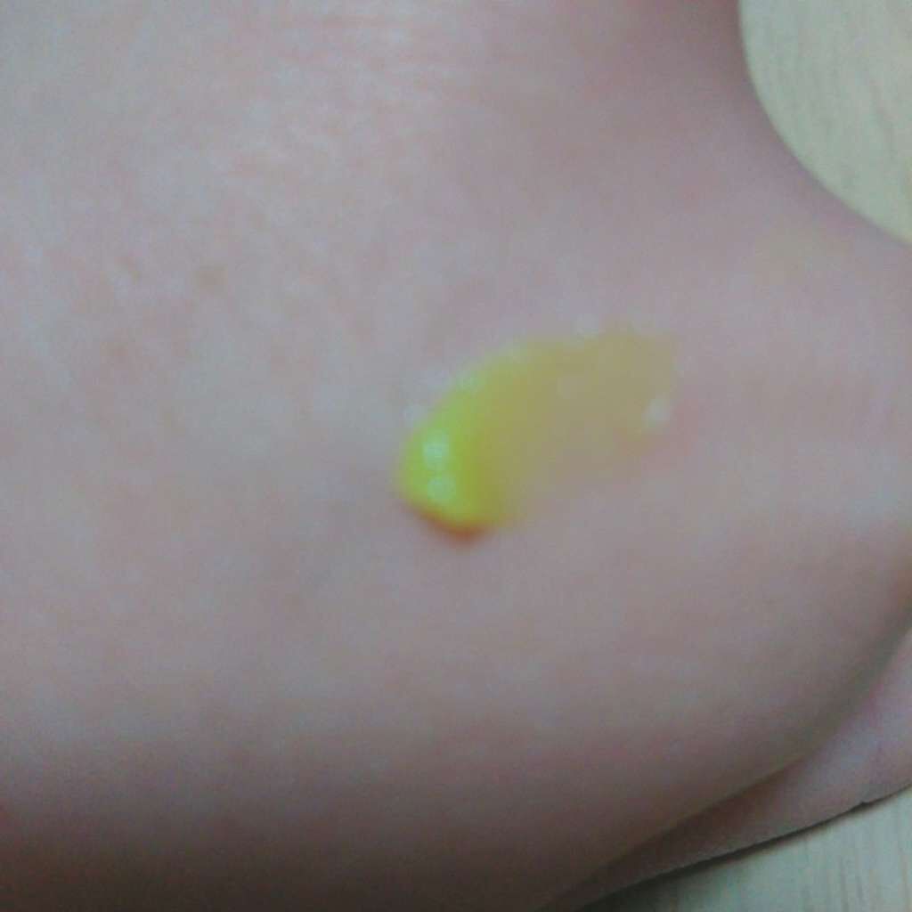 テラ・コートリル 軟膏(医薬品)/ジョンソン・エンド・ジョンソン/その他を使ったクチコミ(3枚目)