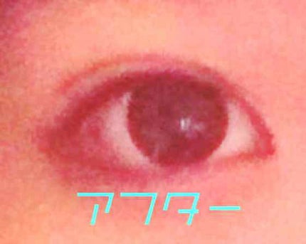 しなやかフィット/DAISO/二重まぶた用アイテムを使ったクチコミ(1枚目)