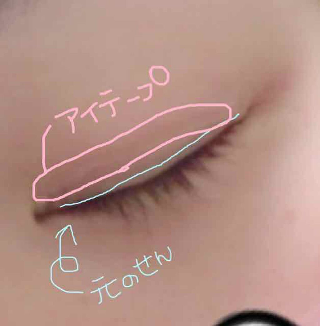 のびーるアイテープ(絆創膏タイプ、レギュラー)/DAISO/二重まぶた用アイテムを使ったクチコミ(3枚目)