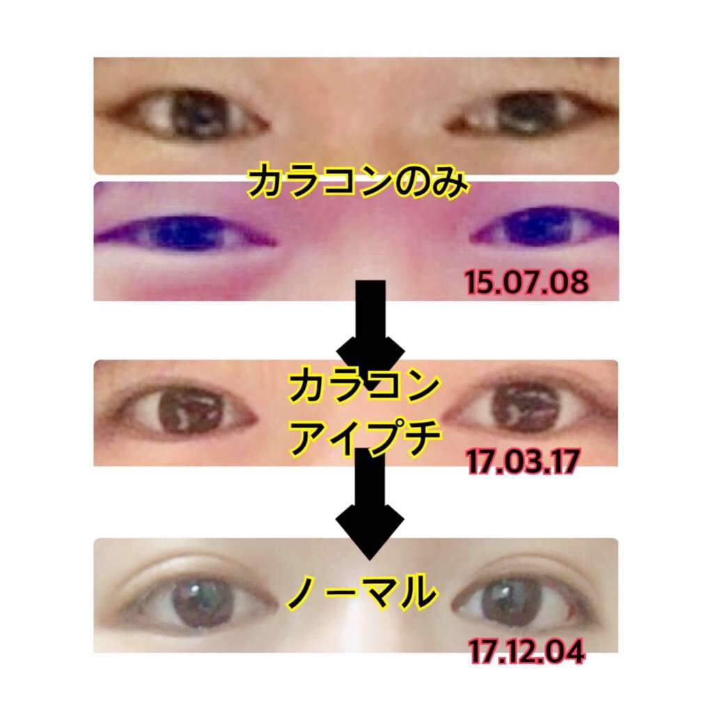 ダブルアイリキッド/Automatic Beauty/二重まぶた用アイテムを使ったクチコミ(2枚目)