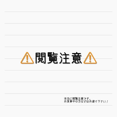 化粧水・敏感肌用・高保湿タイプ/無印良品/化粧水を使ったクチコミ（2枚目）