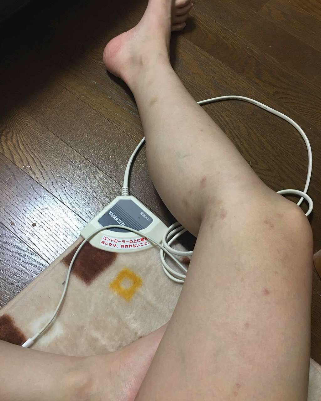 HPローション(医薬品)/ノバルティス ファーマ/その他を使ったクチコミ（3枚目）