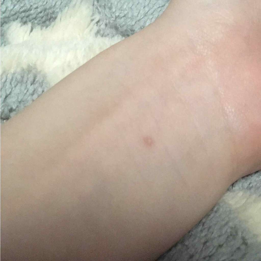 スポッツカバー ファウンデイション/SHISEIDO/クリームコンシーラーを使ったクチコミ（2枚目）