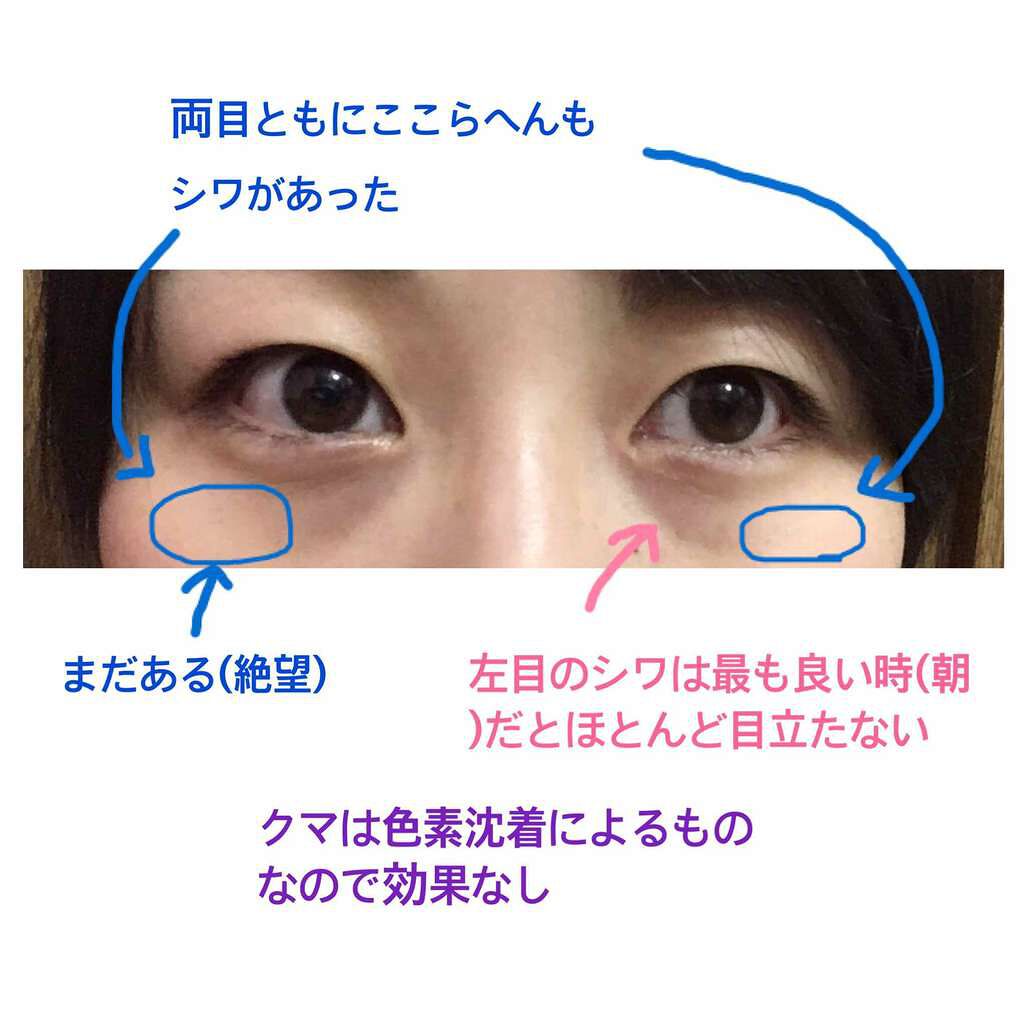 THE アイクリーム/UZU BY FLOWFUSHI/アイケア・アイクリームを使ったクチコミ(3枚目)