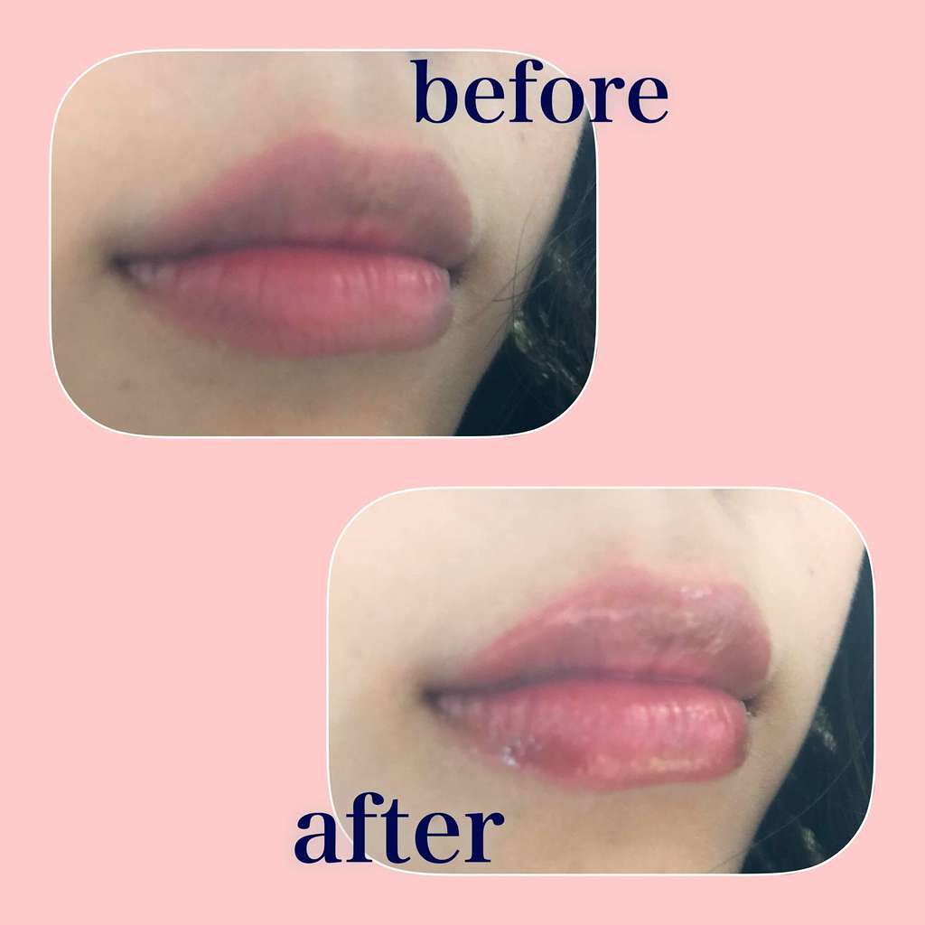 【旧】ディオール アディクト リップ マキシマイザー/Dior/リップグロスを使ったクチコミ(2枚目)