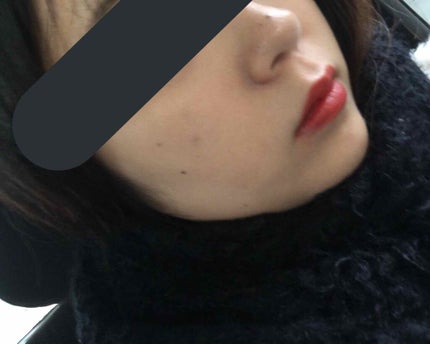 スポッツカバー ファウンデイション/SHISEIDO/クリームコンシーラーを使ったクチコミ(2枚目)