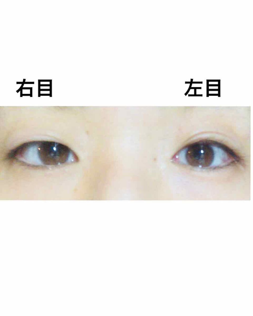 アイトーク/アイトーク/二重まぶた用アイテムを使ったクチコミ(2枚目)