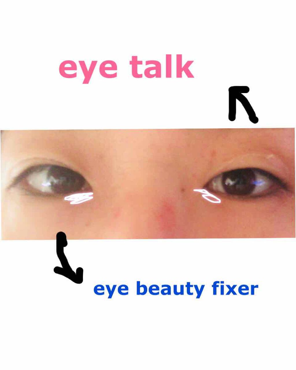 アイビューティー フィクサー WP/アストレア ヴィルゴ/二重まぶた用アイテムを使ったクチコミ（3枚目）