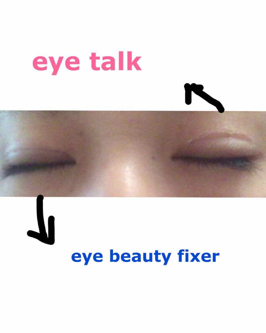 アイビューティー フィクサー WP/アストレア ヴィルゴ/二重まぶた用アイテムを使ったクチコミ（2枚目）